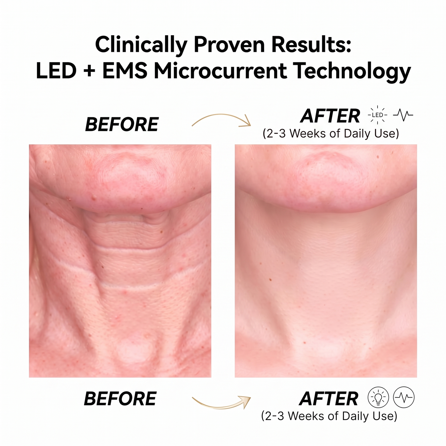 7-Color LED Face & Neck Massager | Anti-Wrinkle Vibration